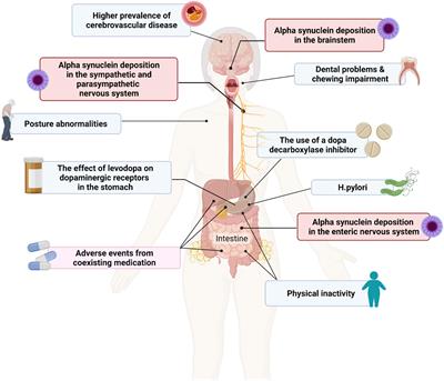 Management of dysphagia and gastroparesis in Parkinson’s disease in real-world clinical practice – Balancing pharmacological and non-pharmacological approaches